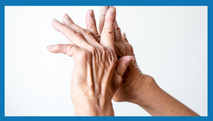 Finger Arthritis علاج التهاب مفاصل الاصابع