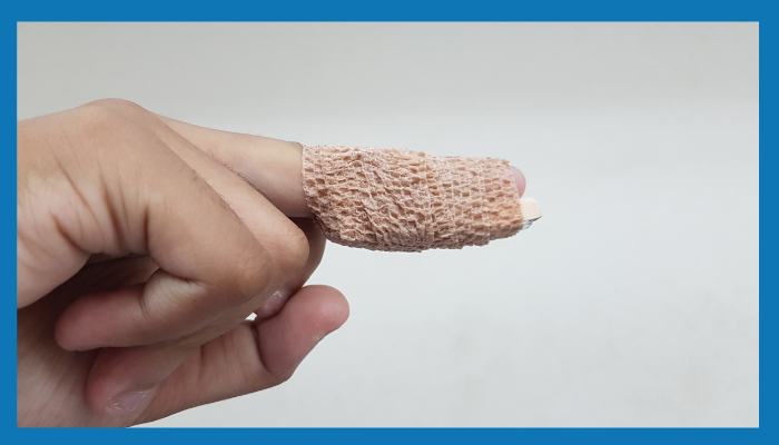 Mallet Finger