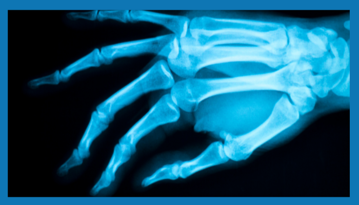 Treatments and Conditions in Hand and Wrist