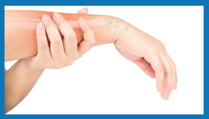Wrist Fracture كسر المعصم