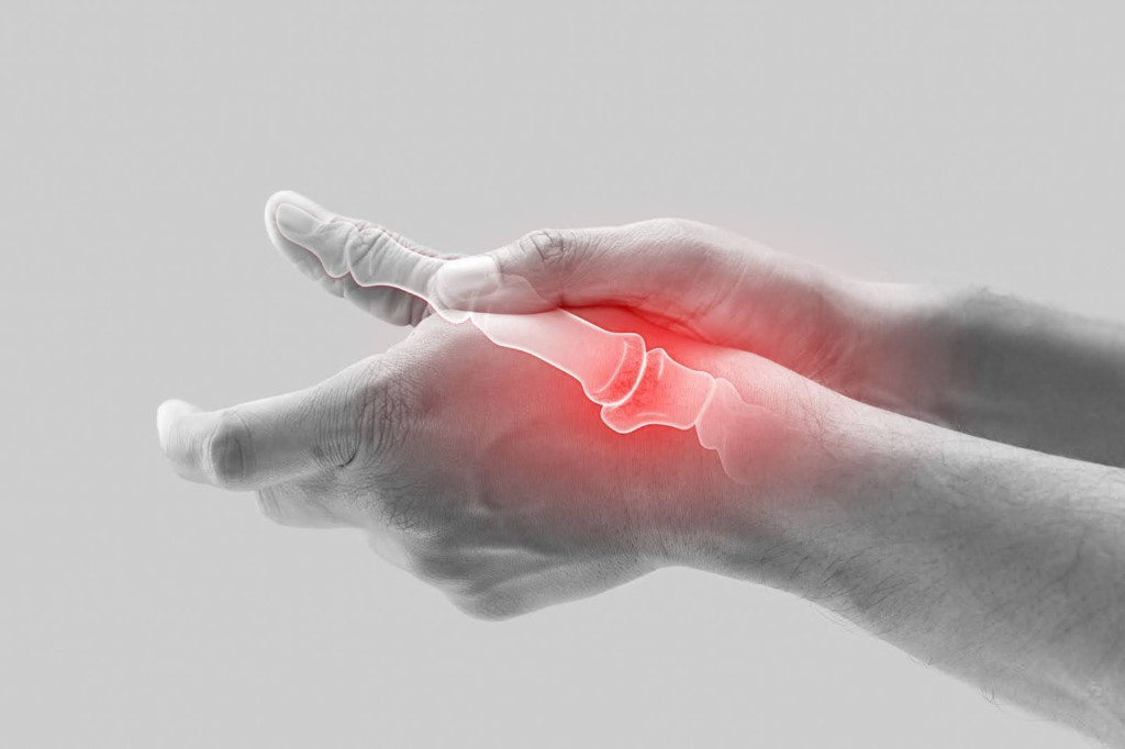 hand having inflammation due to broken scaphoid