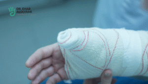 The Link Between Acute Scaphoid Fractures and Sports Injuries 17 scaphoid bone fracture