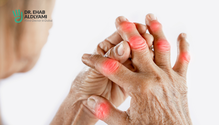 Thumb CMC Joint Replacement: A Life-Changing Surgical Option