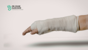 Scaphoid Fracture Symptoms