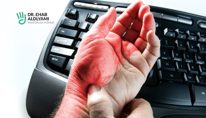 Carpal Tunnel Syndrome 2