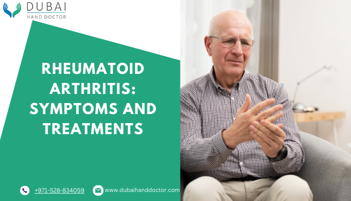 rheumatoid arthritis treatment by DR Ehab Aldlyami