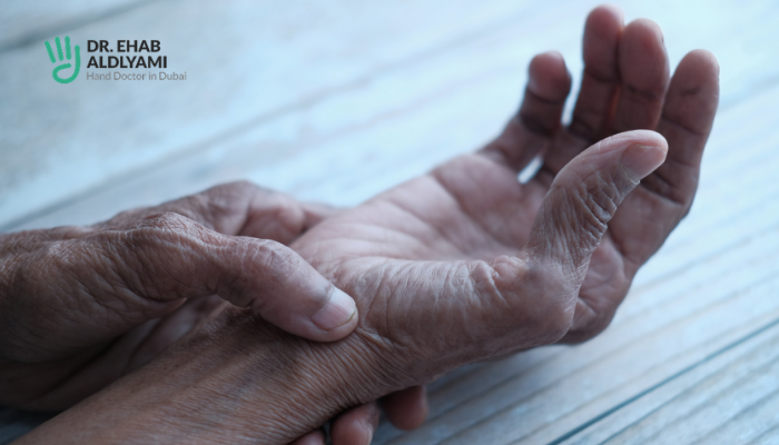 Wrist Sprain vs Scaphoid Fracture