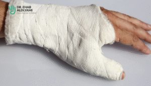 Broken hand diagnosis and treatment