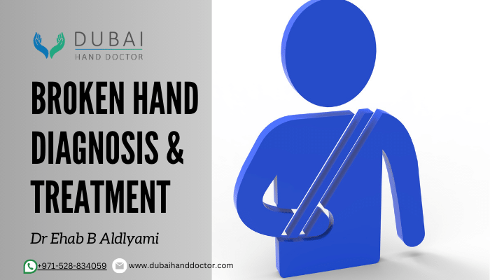 Broken hand - Diagnosis & Treatment