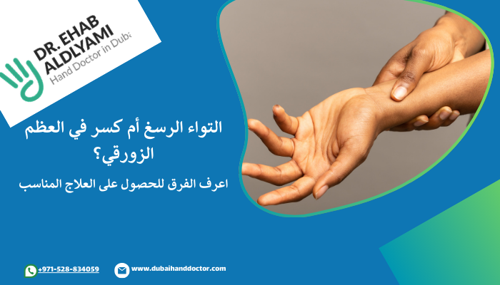 الفرق بين اعراض كسر اليد و اعراض التواء اليد
