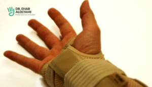 Broken hand vs sprained hand