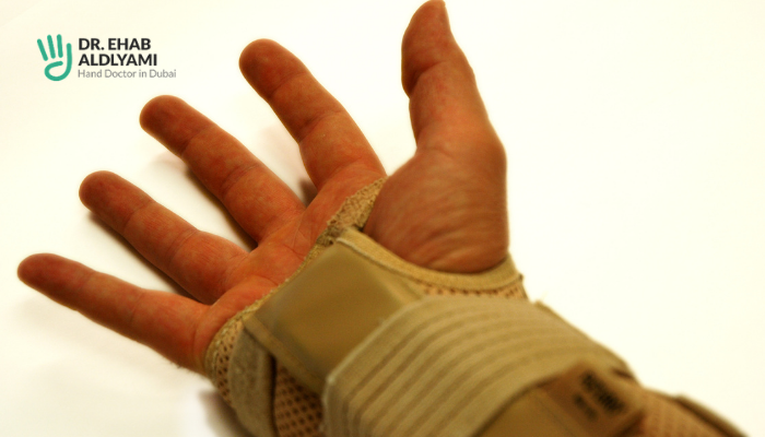 Broken hand vs sprained hand