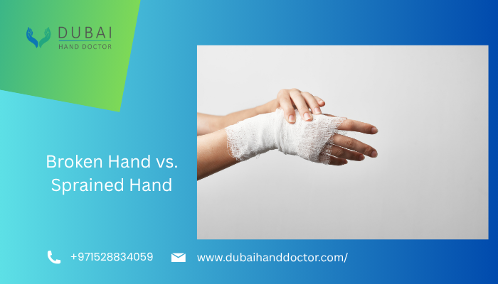 Broken hand vs Sprained hand