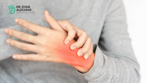 nerve compression