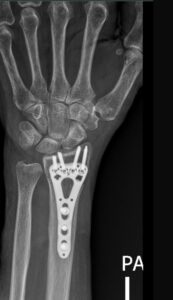 Xray hand 3 167 x 290 px