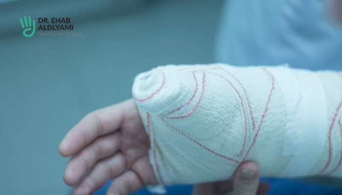 scaphoid bone fracture