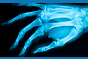 Treatments and Conditions in Hand and Wrist